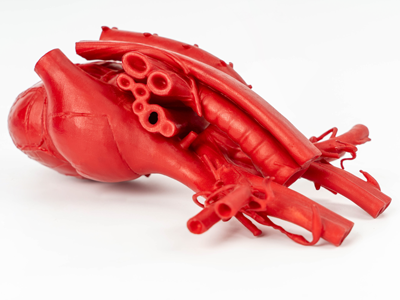 3d打印医疗器官模型心脏案例